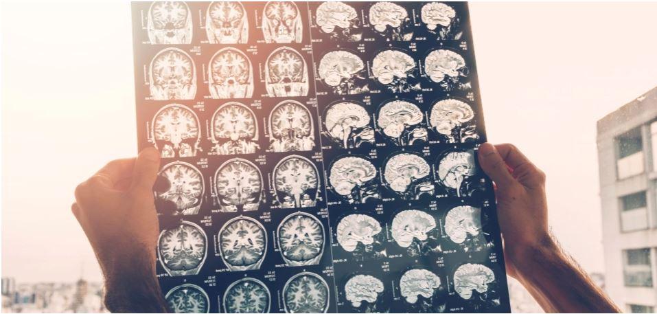 Neurologové: všichni pacienti musí dostat kvalitní péči. Pomohou nové standardy a registr ReMuS
